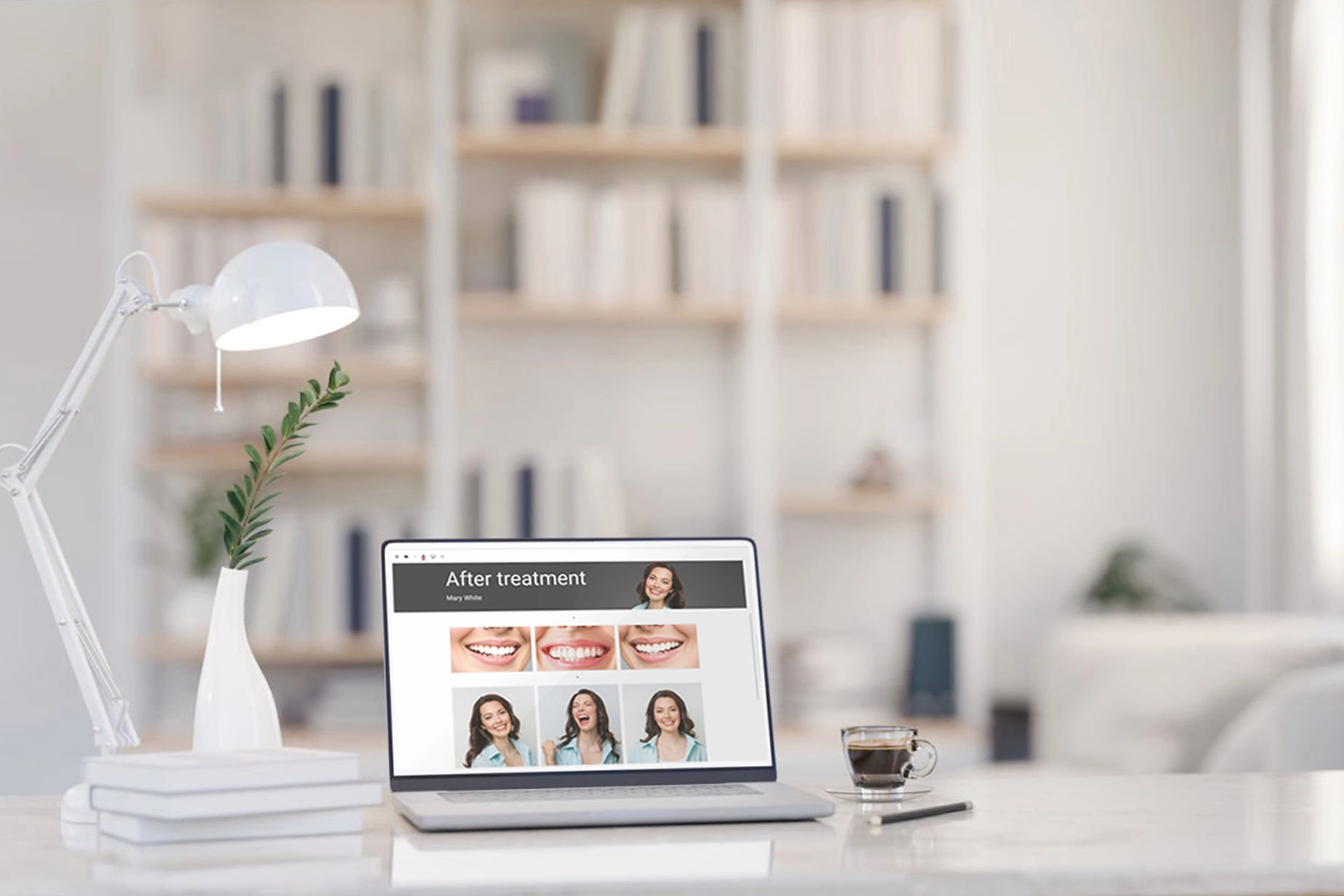 Cover image for article 'Before & After Gallery That Builds Trust'